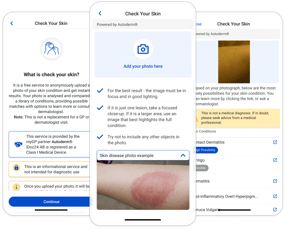 Check your skin concerns with an AI powered skin scanner